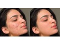 photo-retouching-service-small-0