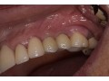 trusted-dental-clinic-in-tijuana-comprehensive-care-for-a-brighter-healthier-smile-small-0