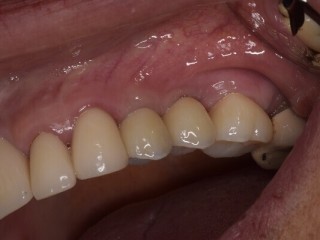 trusted-dental-clinic-in-tijuana-comprehensive-care-for-a-brighter-healthier-smile