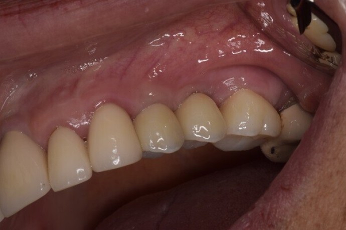 trusted-dental-clinic-in-tijuana-comprehensive-care-for-a-brighter-healthier-smile-big-0