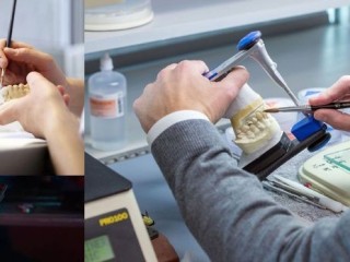 hitec-dental-ceramics-dental-lab-implants-and-crowns